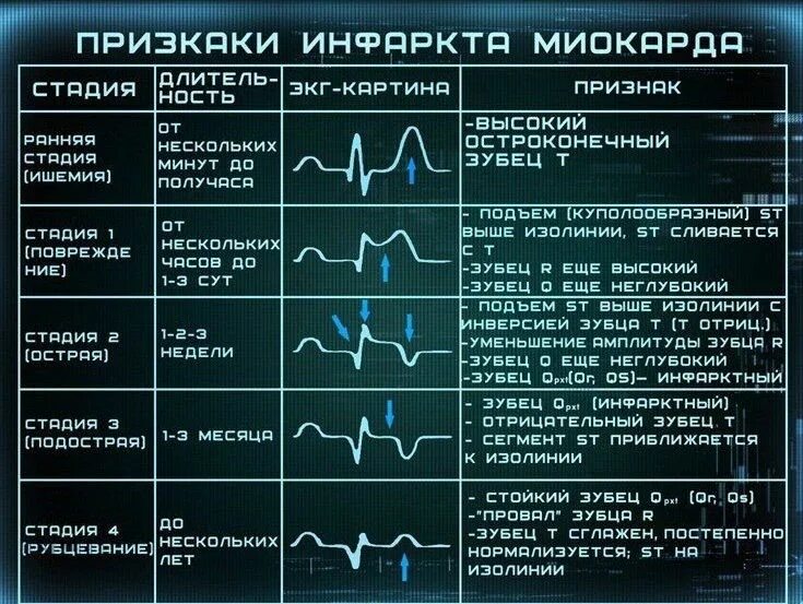 Расшифровать кардиограмму сердца онлайн по фото Пин от пользователя dead на доске Инста ❤ Медицина, Уроки биологии, Медицинский