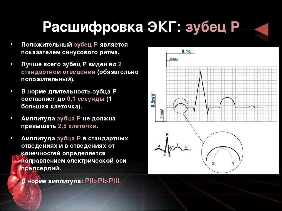 Расшифровать кардиограмму сердца онлайн по фото Расшифровка экг р