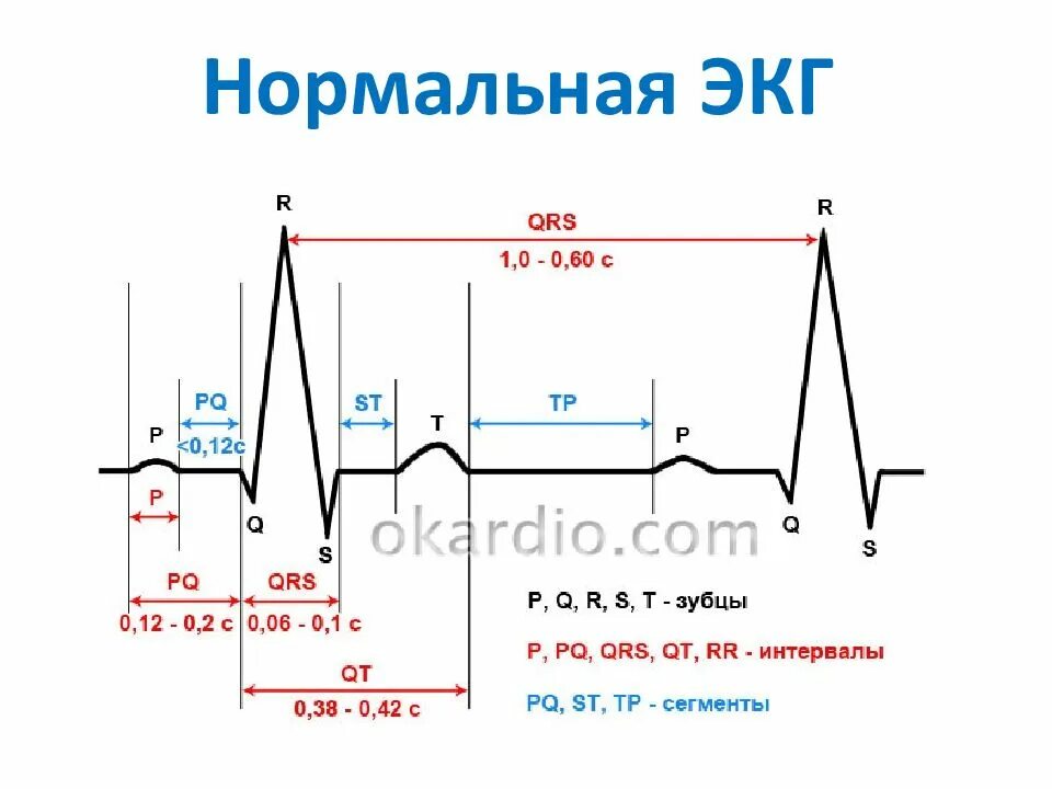 Расшифровать кардиограмму сердца онлайн по фото Кардиограмма как понять: найдено 90 изображений