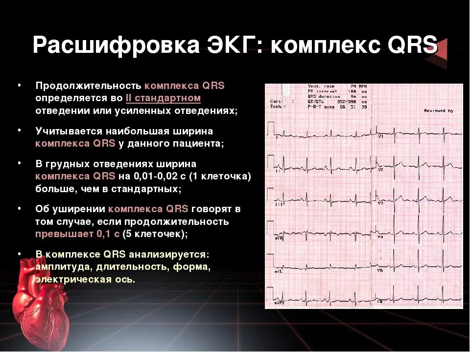 Расшифровать кардиограмму сердца онлайн по фото Экг сетка