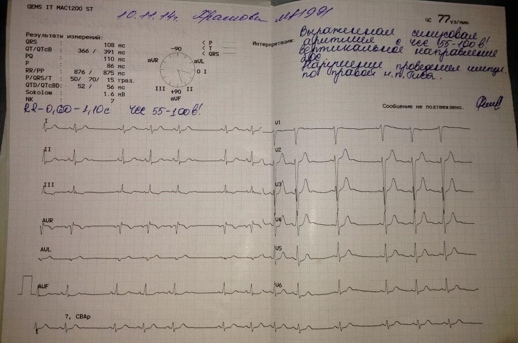 Расшифровка кардиограммы сердца онлайн по фото ЭКГ расшифровка - Вопрос кардиологу - 03 Онлайн
