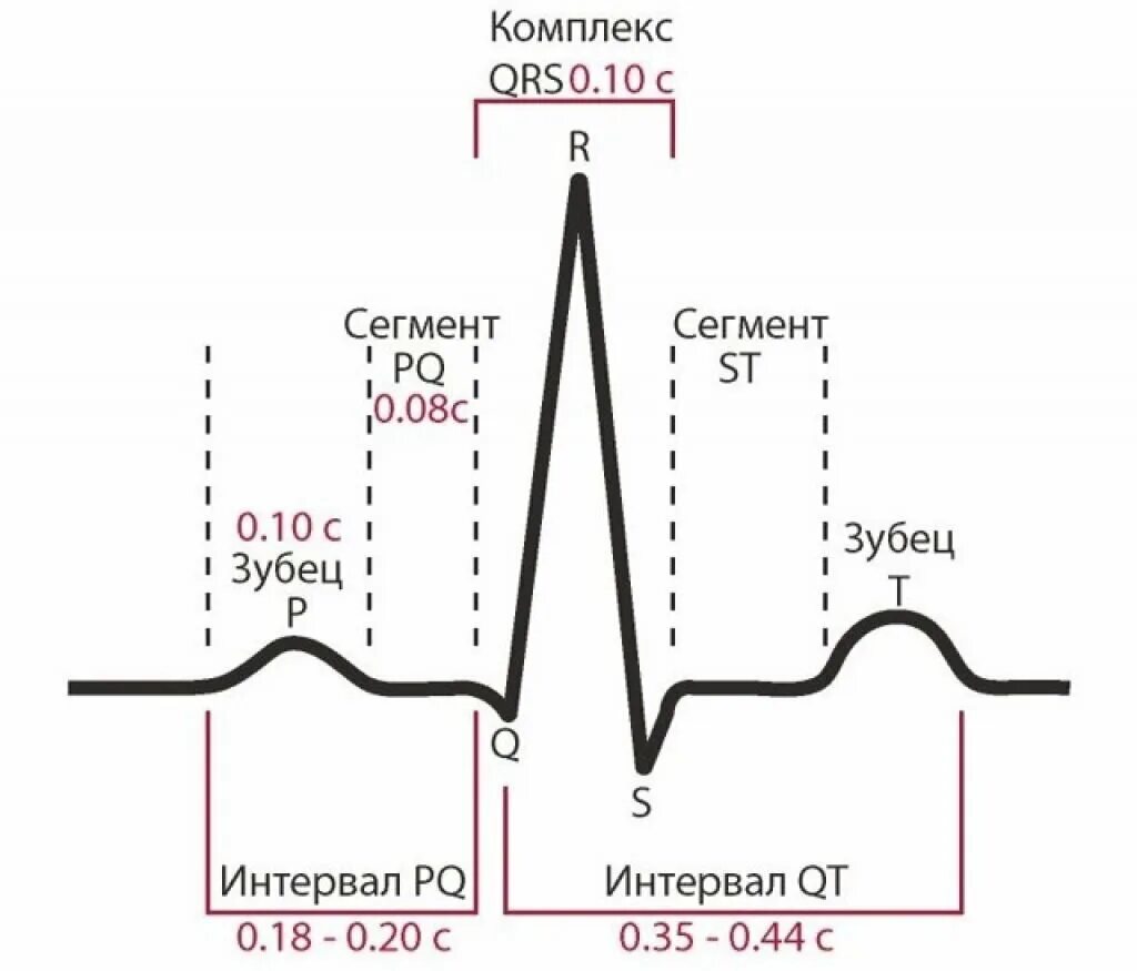 Расшифровка кардиограммы сердца онлайн по фото КАК ПРОЧИТАТЬ ЭКГ? Weird_Med_Student Дзен