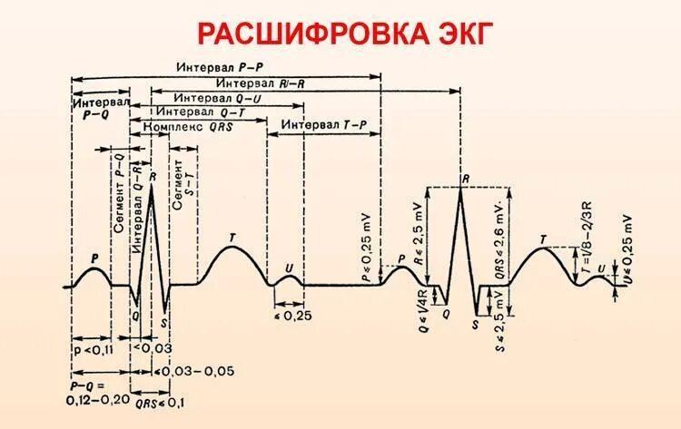 Расшифровка кардиограммы сердца онлайн по фото Как расшифровывают ЭКГ, какие показатели имеют значение