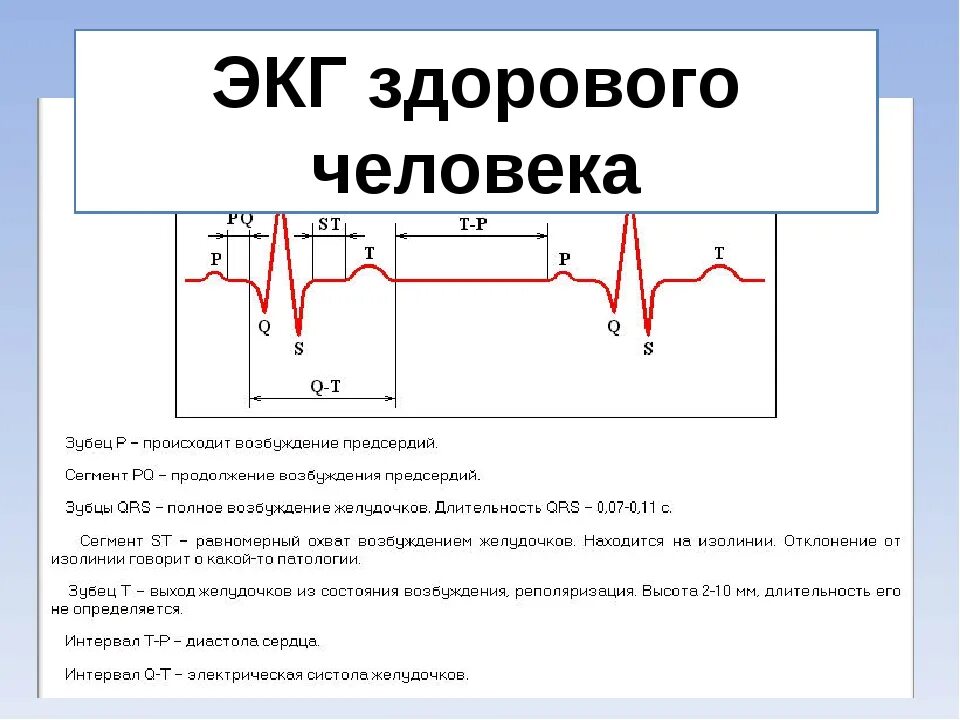 Расшифровка кардиограммы сердца онлайн по фото Экг санкт петербург