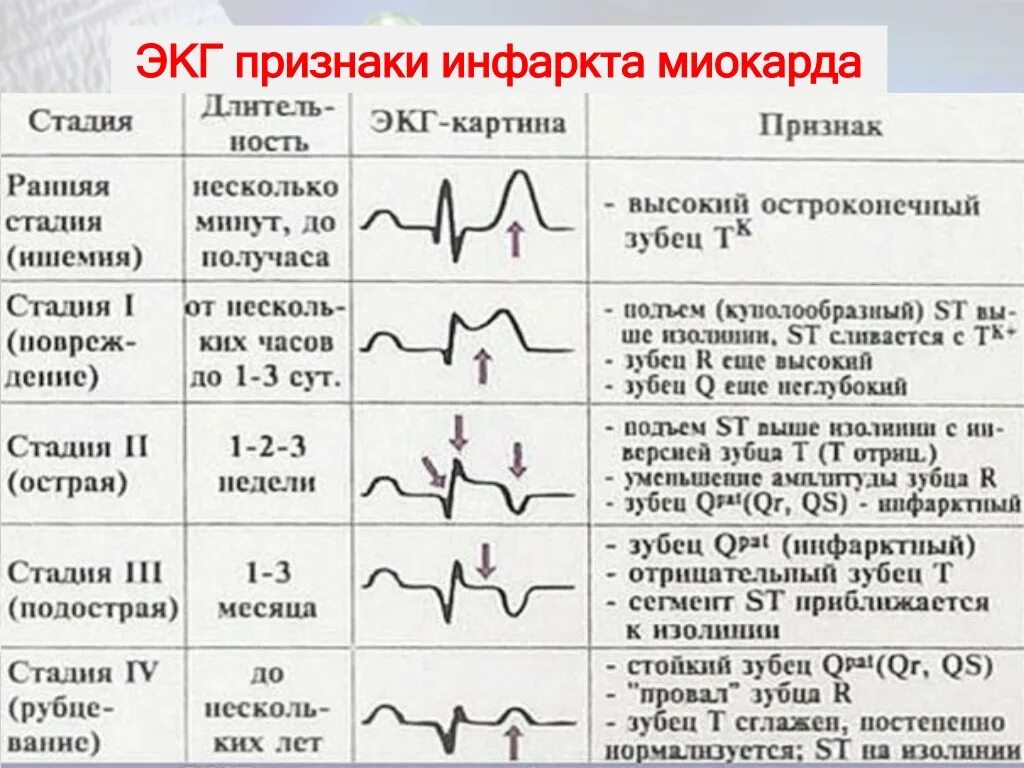 Расшифровка кардиограммы сердца онлайн по фото PPT - Бюджетное профессиональное образовательное учреждение Воронежской области 