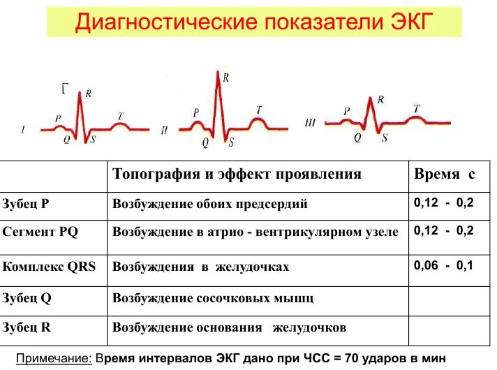 Расшифровка кардиограммы сердца онлайн по фото бесплатно Что значит синусовый ритм сердца на экг