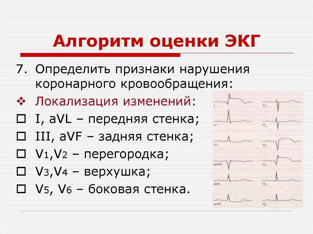 Расшифровка кардиограммы сердца онлайн по фото бесплатно Экг расшифровка что означает