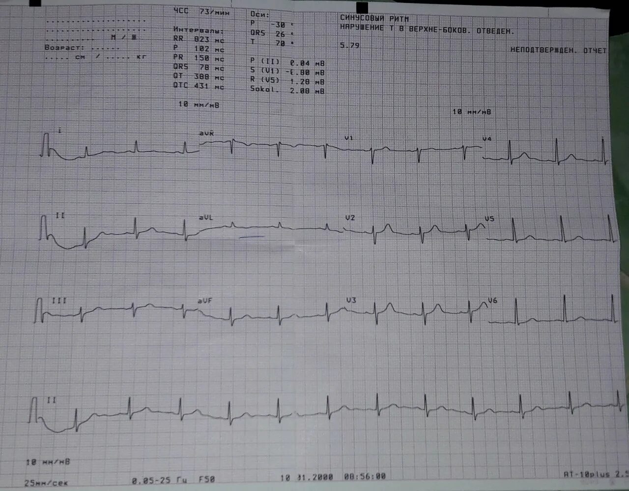 Что можно сказать по кардиограмме? Перезадаю вопрос полностью по вашей MedAboutM