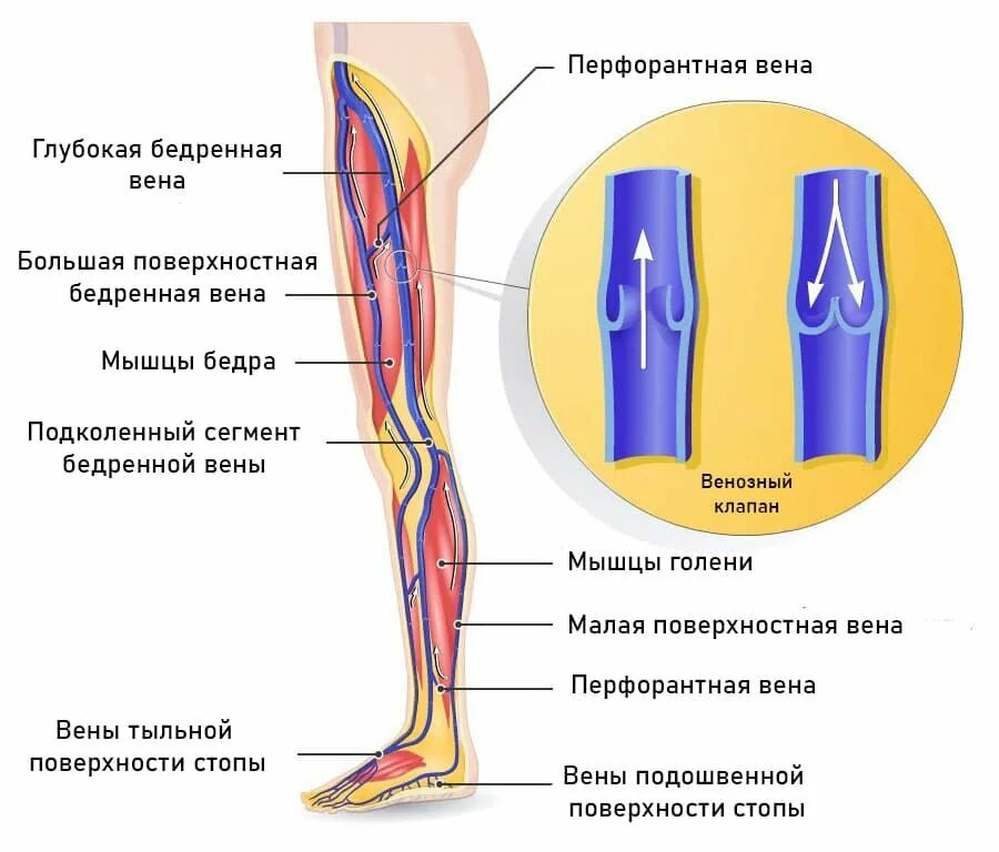 Расширение вен нижних конечностей фото Картинки ПЕРФОРАНТЫ ГОЛЕНИ