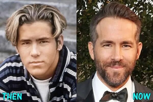 Райан рейнольдс фото до и после пластики Ryan Reynolds Plastic Surgery - Hair Transplant, Teeth Fix, Nose Job?