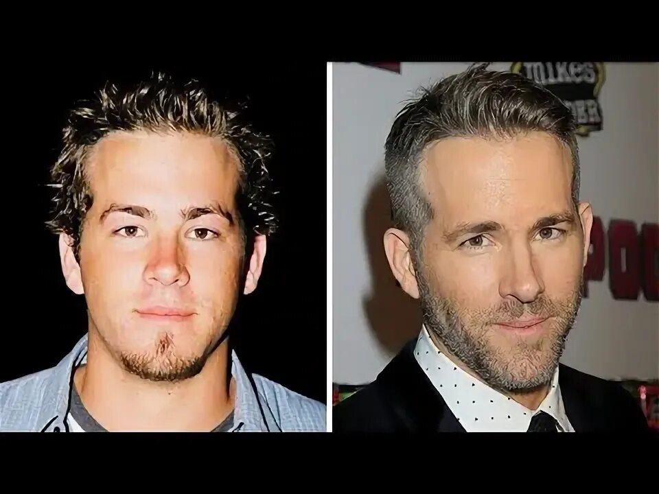 Райан рейнольдс фото до и после пластики Ryan Reynolds From 1 to 41 Years Old - YouTube