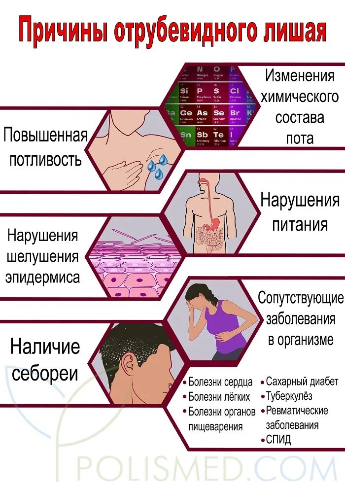 Разноцветный лишай фото и описание Отрубевидный лишай. Причины, симптомы, признаки, диагностика и лечение патологии