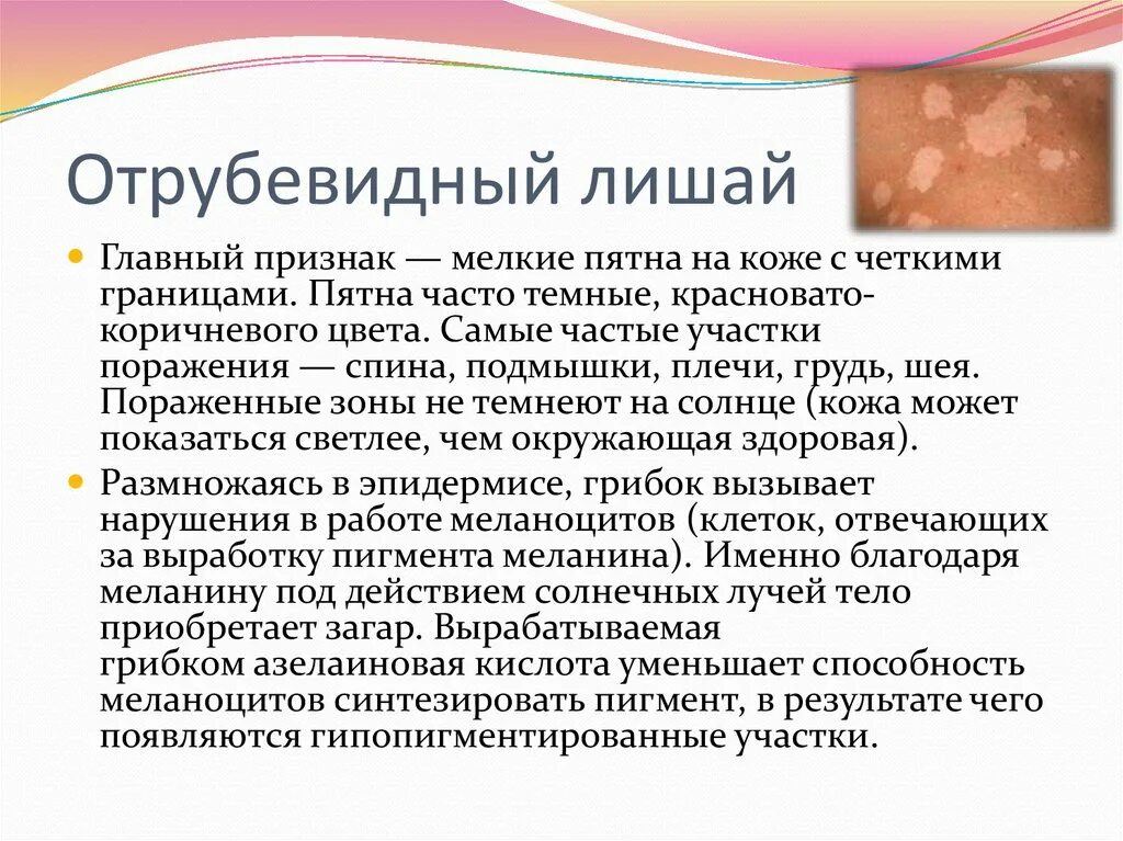 Разноцветный лишай фото лечение Микозы этиология