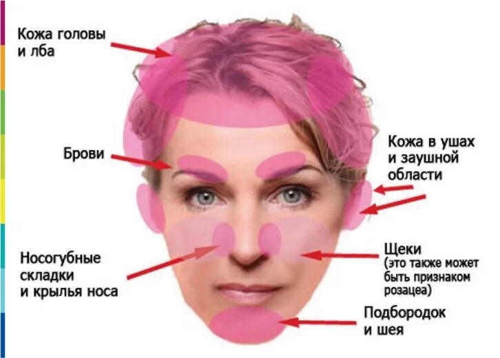 Разновидность дерматита на лице фото DERMAQUEST " Себорейный дерматит и розацеа - в чем разница Статьи Отзывы Купить