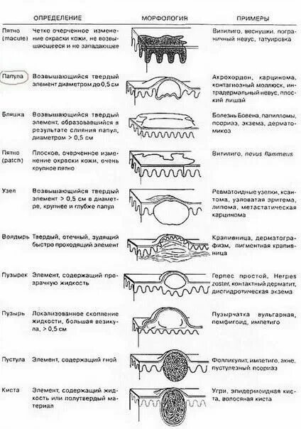 Разновидности сыпи с фото и описанием Pin by Tanya Melnichuk on здоров'я Word search puzzle, Words, Word search