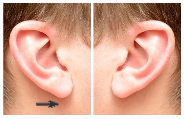 Разные уши фото How to Paint a Realistic Ear in Adobe Photoshop Envato Tuts+