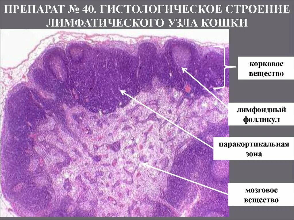 Увеличение глоточной миндалины