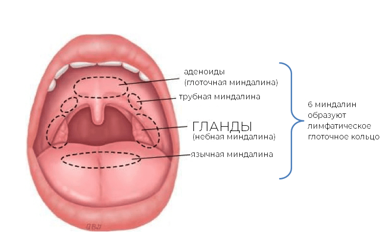 Разрастание лимфоидной ткани миндалины фото Как переводится "ангина" с разных языков мира? Мама-док Дзен