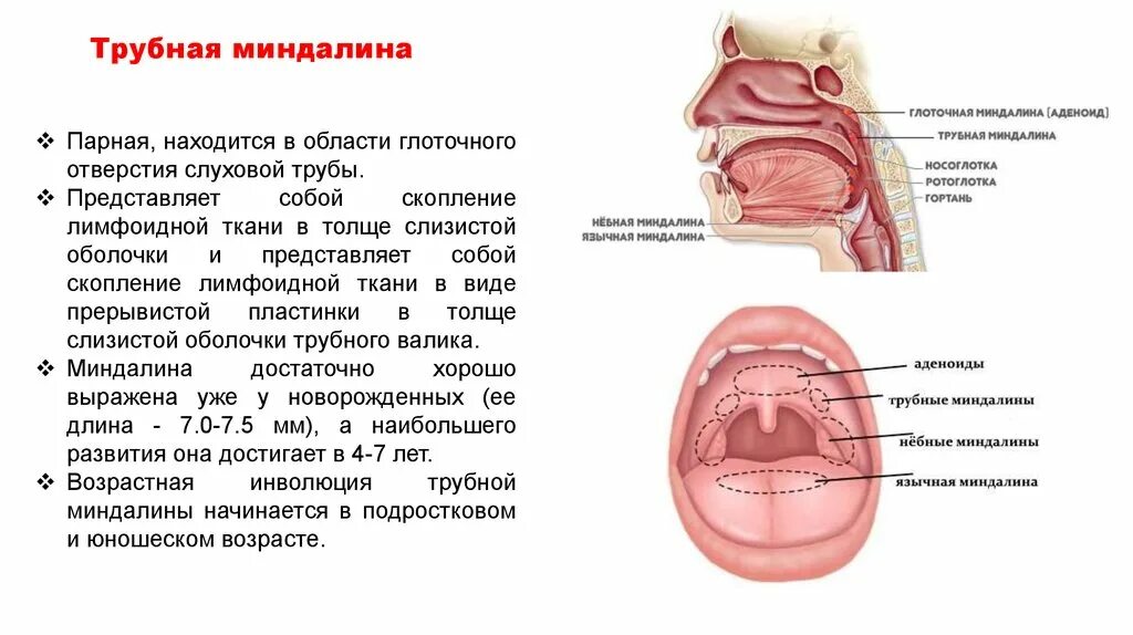 Разрастание лимфоидной ткани миндалины фото Увеличение глоточной миндалины