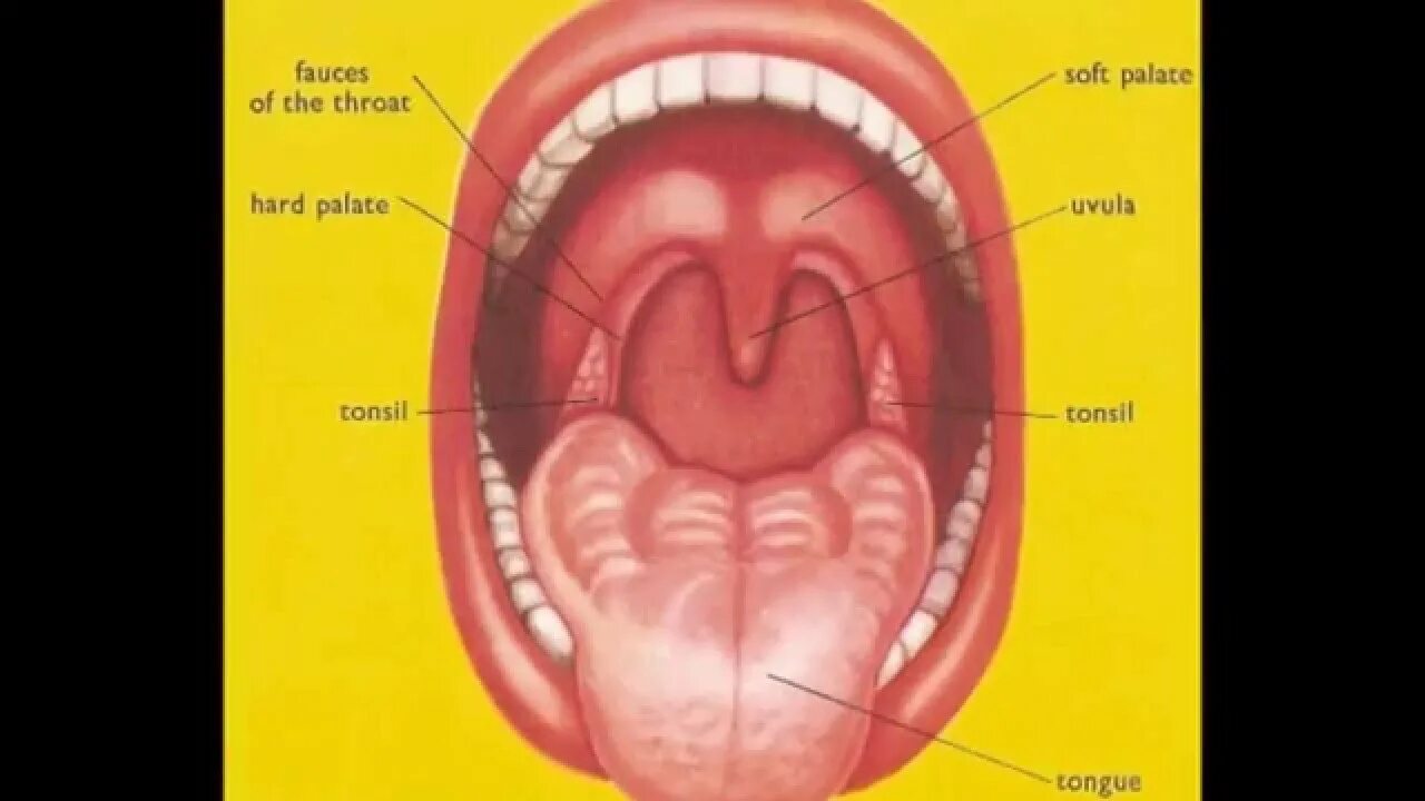 Разрастание лимфоидной ткани в горле фото What are Tonsils and Adenoids (Sore throat pain) in children? Tonsils Adenoids T