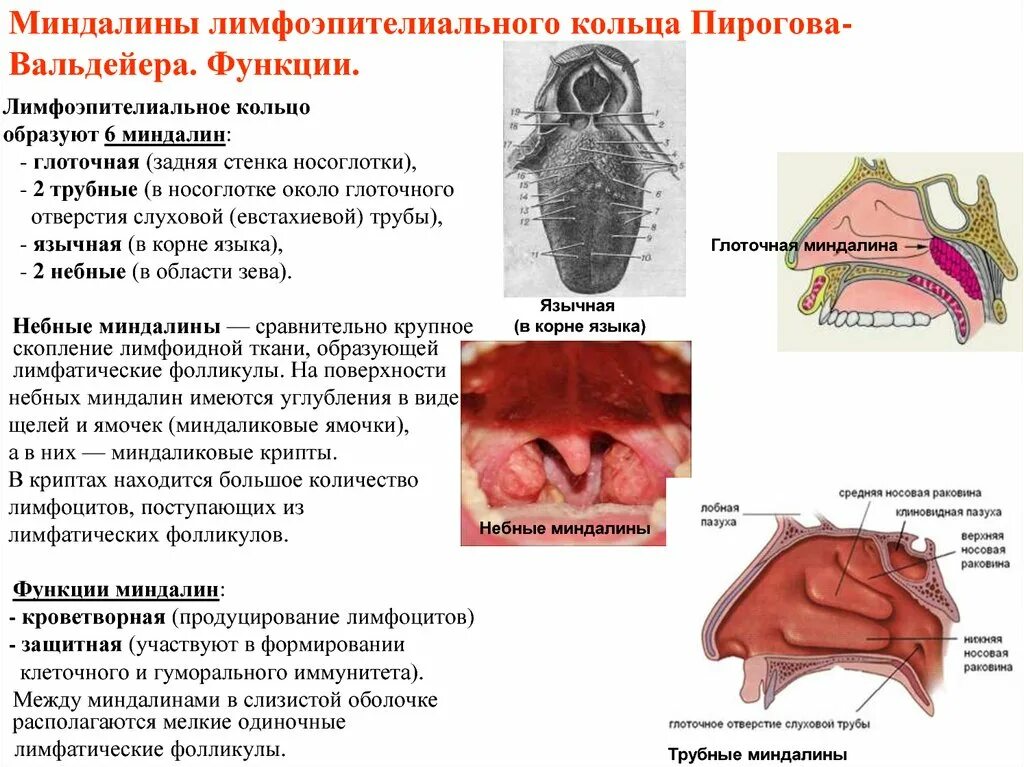 Разрастание лимфоидной ткани в горле фото Картинки ГЛОТКА ЛИМФОИДНОЕ КОЛЬЦО ГЛОТКИ