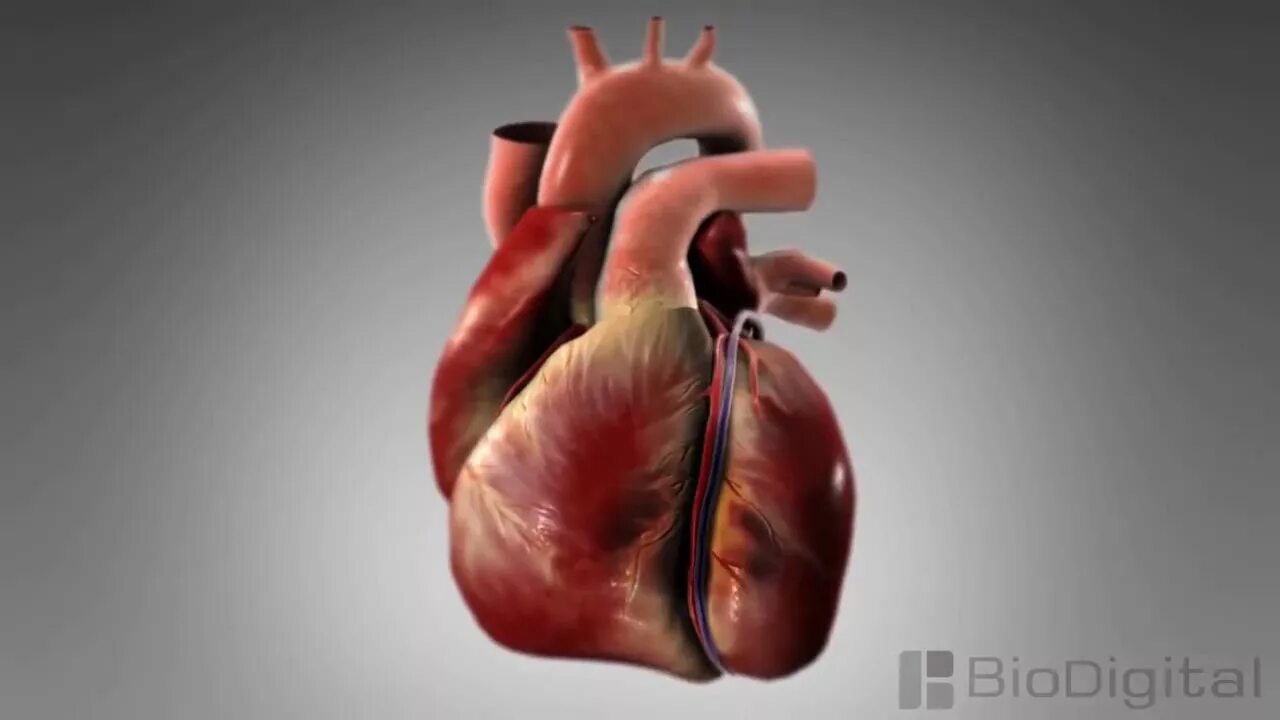 Разрыв сердца фото 3D Medical Animation What is a Heart Attack. - YouTube