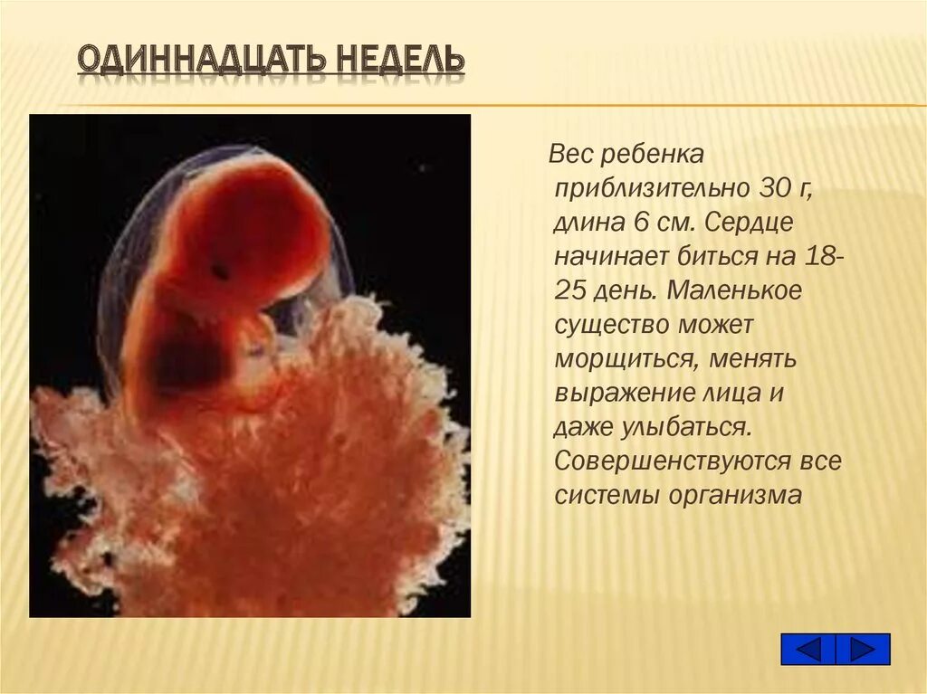 Развитие плода 11 недель фото Моральные проблемы репродукции человека - презентация онлайн