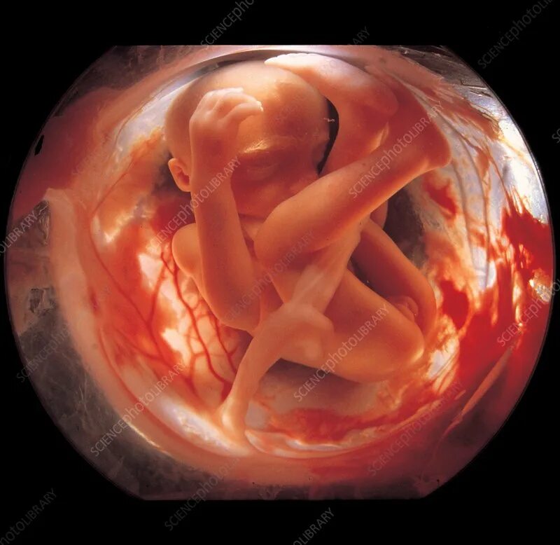 Развитие плода 14 недель фото Foetus in amniotic sac, 26 weeks - Stock Image - C048/7865 - Science Photo Libra