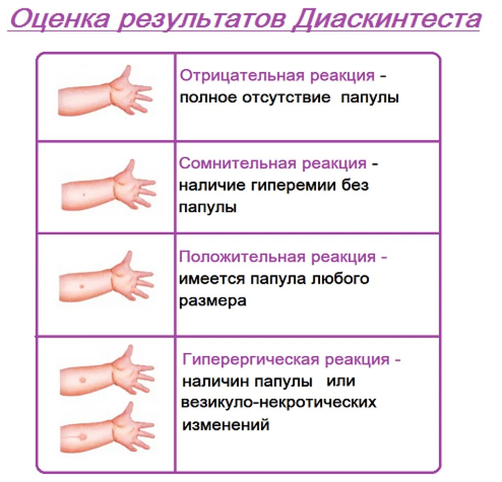 Реакция манту какая должна быть фото Какой должен быть диаскинтест в норме