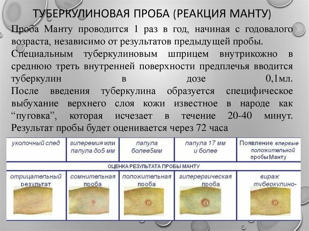 Реакция манту какая должна быть фото Манту в год какая должна быть норма