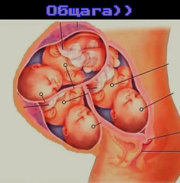 Ребенок в животе 9 месяцев фото Три ребенка в животе