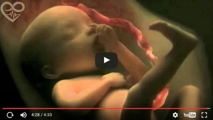 Ребенок внутри матери фото 9 mois de grossesse dans une merveilleuse vidéo de 4 minutes 9 meses embarazo, B