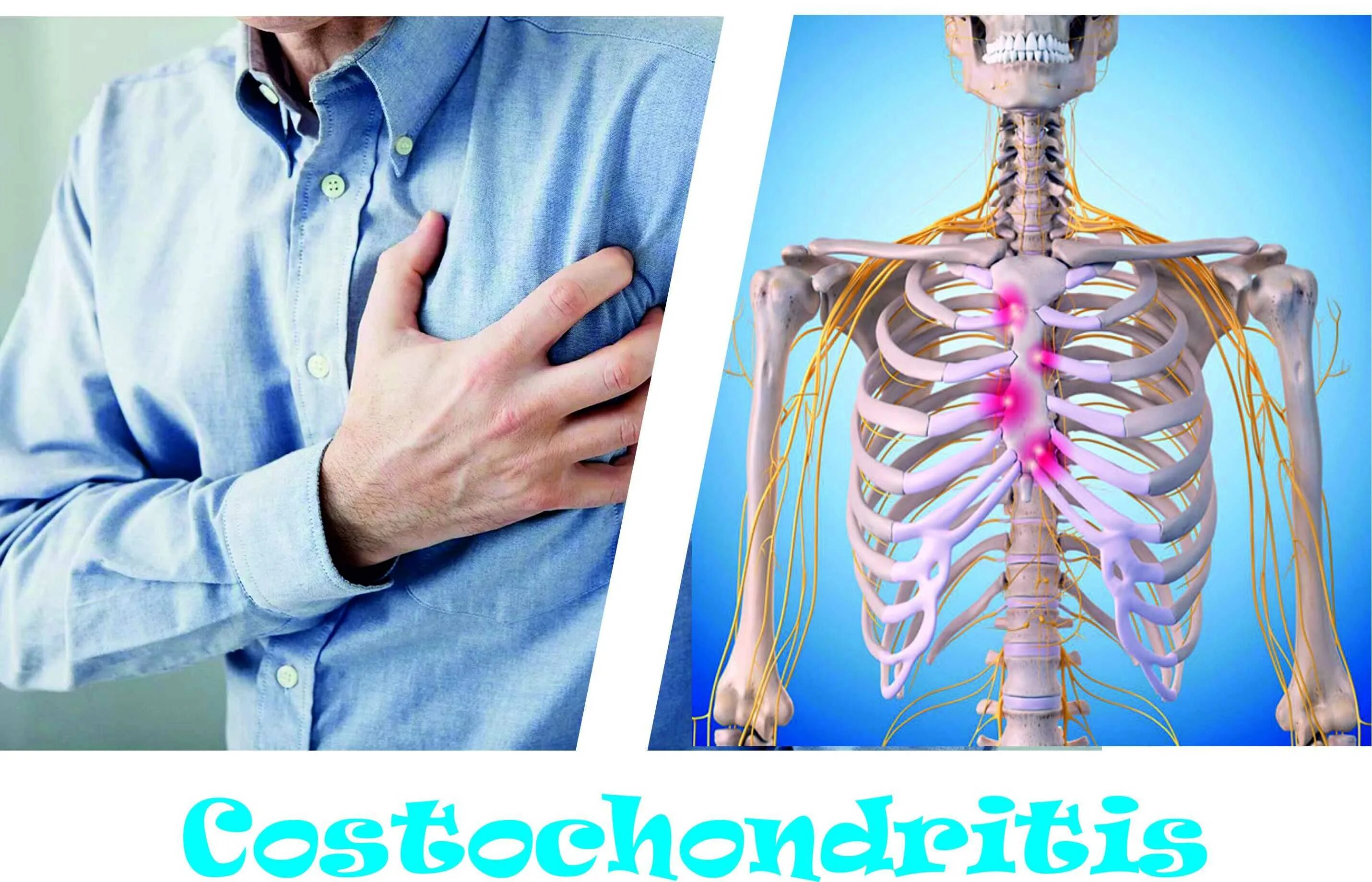 Реберный хондрит симптомы и лечение фото LIVING WITH COSTOCHONDRITIS EVERY WOMAN'S NIGHTMARE! - Steemit