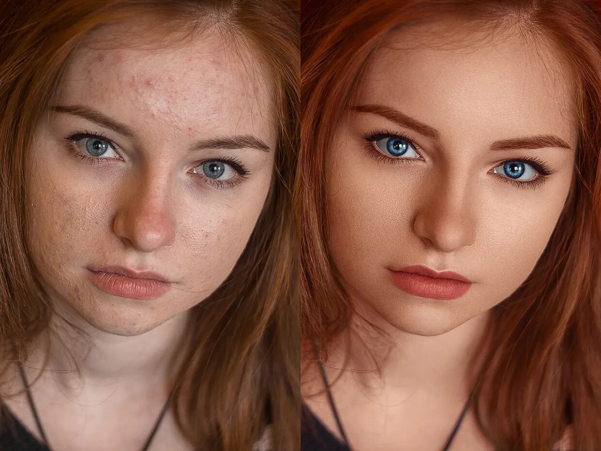 Редактирование фото лица Problem skin retouching. Before and after. (4) Images :: Behance