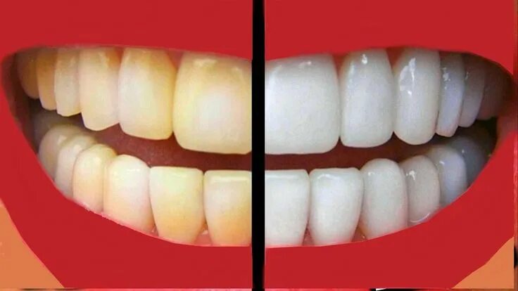 Редактор фото отбелить зубы How We Keep Our Teeth Bright