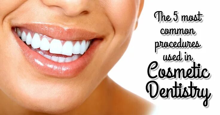 Реклама зубов фото The 5 most common procedures used in #cosmetic #dentistry -Inlays and Onlays -Co