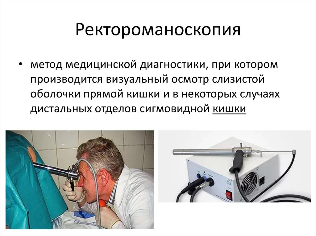 Ректороманоскопия при геморрое как выглядит Можно ректоскопия