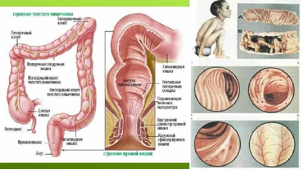 Ректосигмоидный отдел фото Канал прямой кишкой