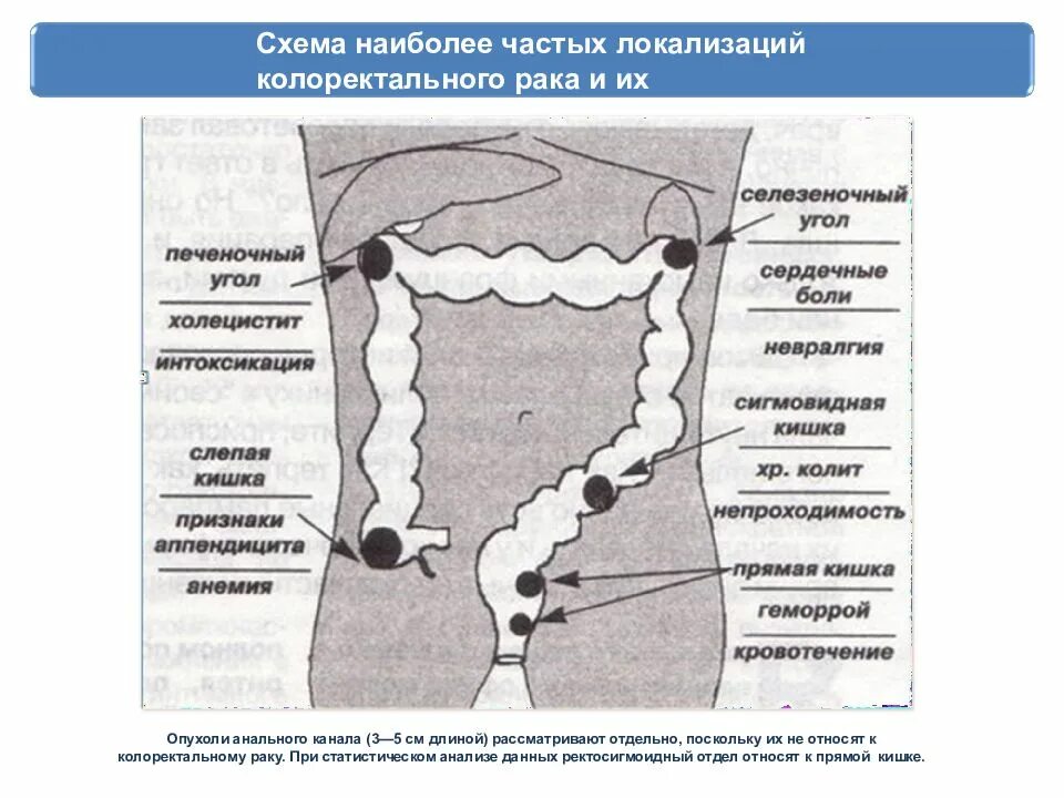 Ректосигмоидный отдел кишечника где находится фото Рак толстой кишки симптомы признаки