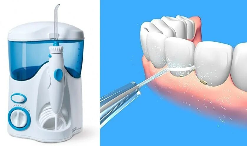 Ремонт ирригатора своими Ирригатор полости рта какой лучше выбрать: отзывы