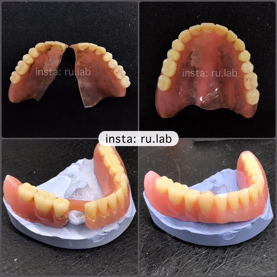 Ремонт протеза своими руками Ремонт зубных протезов Руслан - 89255557151 #зубнойтехник 2019 Ремонт зубных про