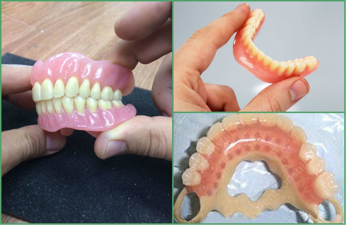 Ремонт зубного протеза своими Какие зубные протезы лучшие, виды, отзывы, рекомендации