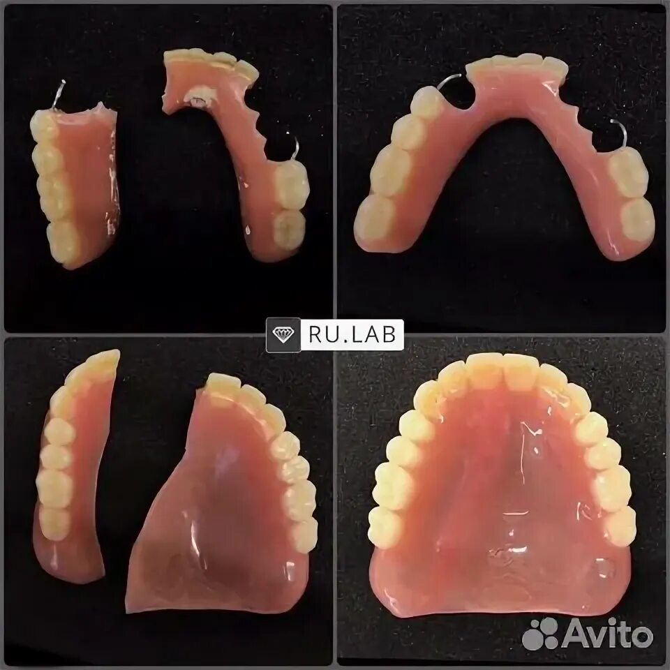 Ремонт зубного протеза своими Ремонт зубных протезов за час в Москве Услуги Авито