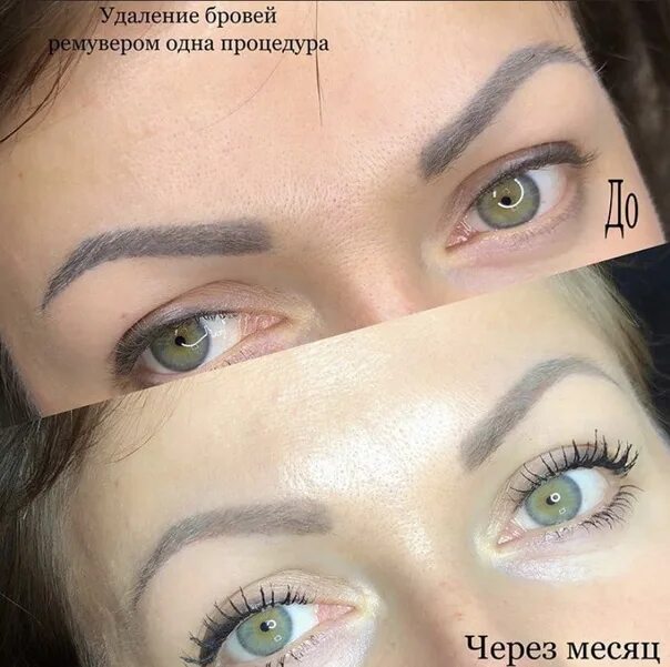 Ремувер для удаления татуажа бровей The safest way to remove a remover Remove eyebrows, lips, arrows 2022 ТАТУАЖ БРО