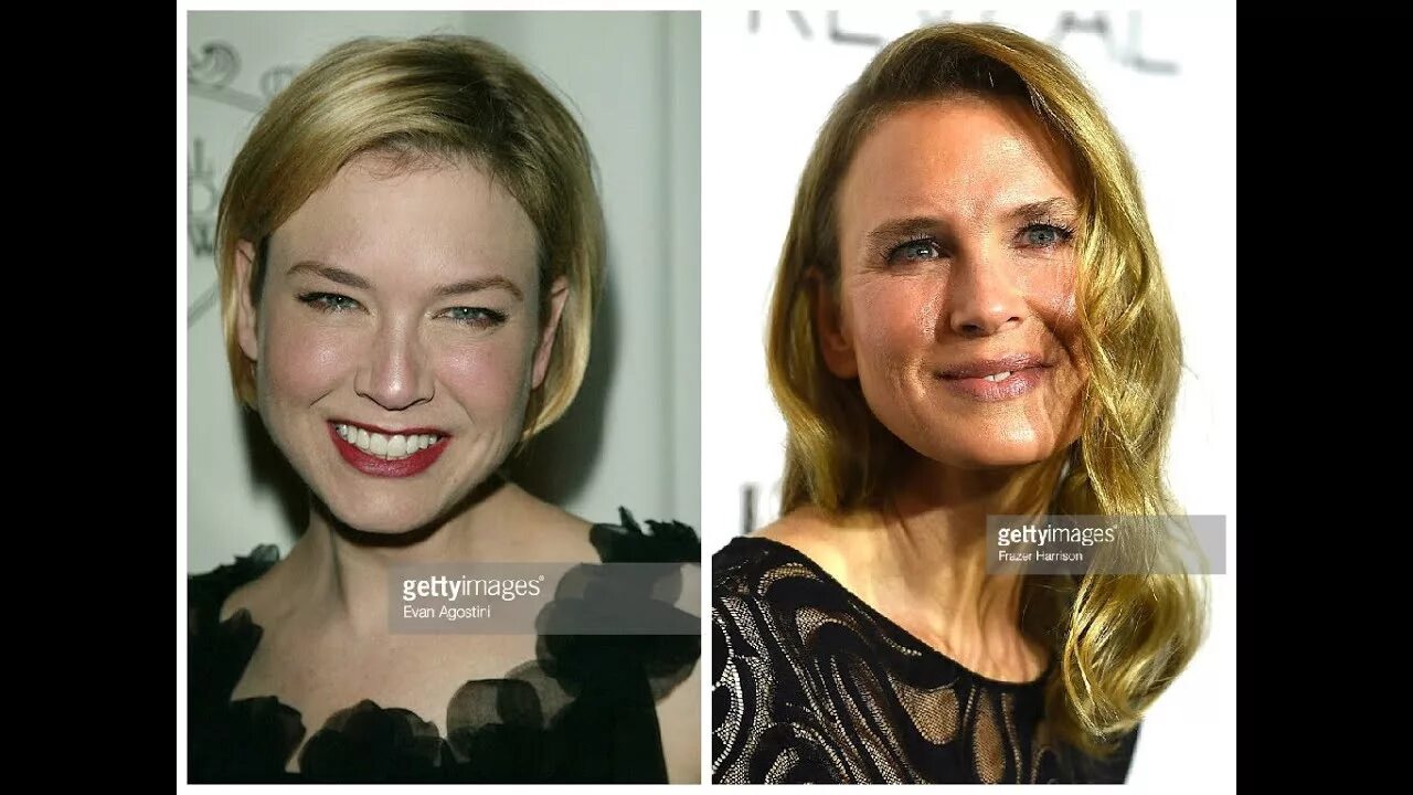 Рене зеллвегер до и после фото Renée Zellweger Plastic Surgery Before and After Photos - YouTube