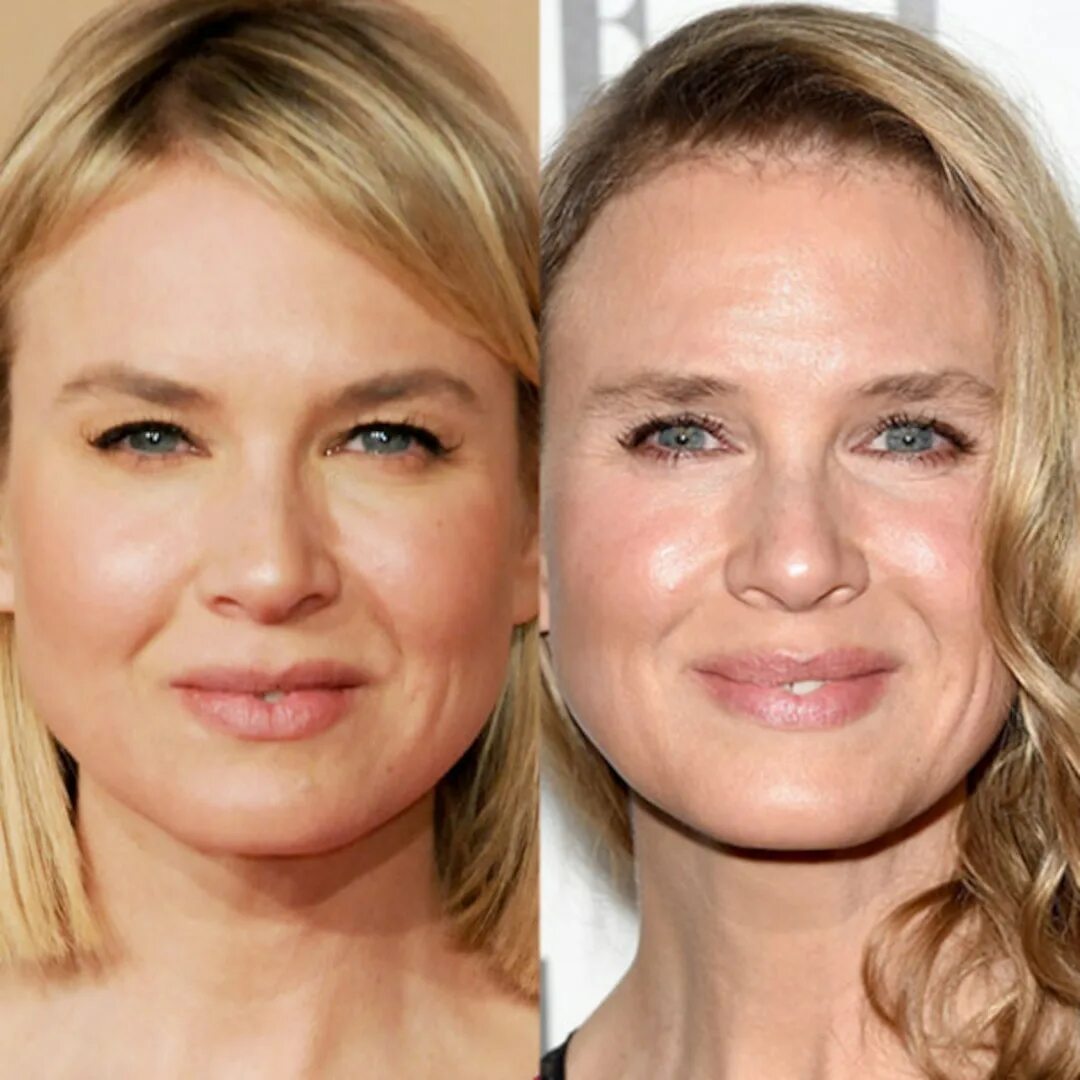 Рене зеллвегер до и после фото Renée Zellweger Explains Why Her Face Looks Different