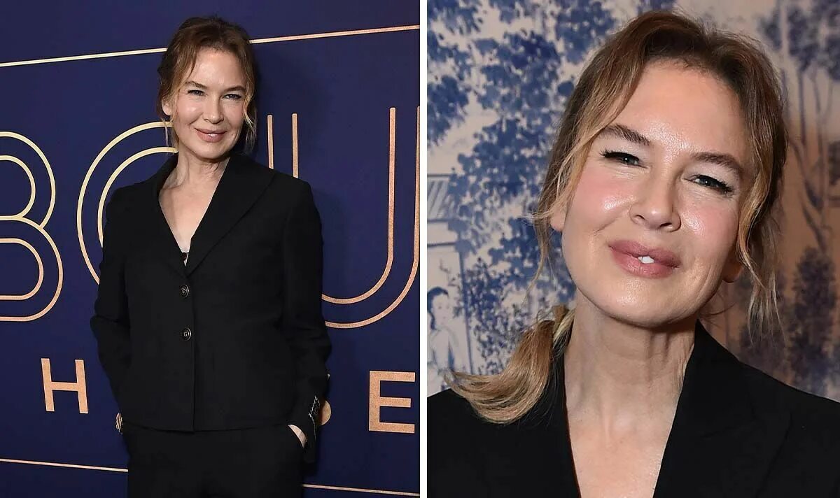 Рене зеллвегер до и после фото Renee Zellweger was once warned she was 'going to die' due to weight issues - wh