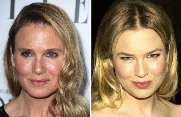 Рене зеллвегер до и после фото Renee Zellweger Explains Changing Face: It's Because I'm So Happy! Renee zellweg