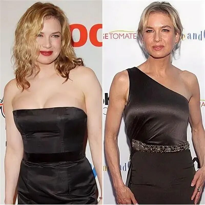 Рене зеллвегер до и после фото Pin on Renee Zellweger