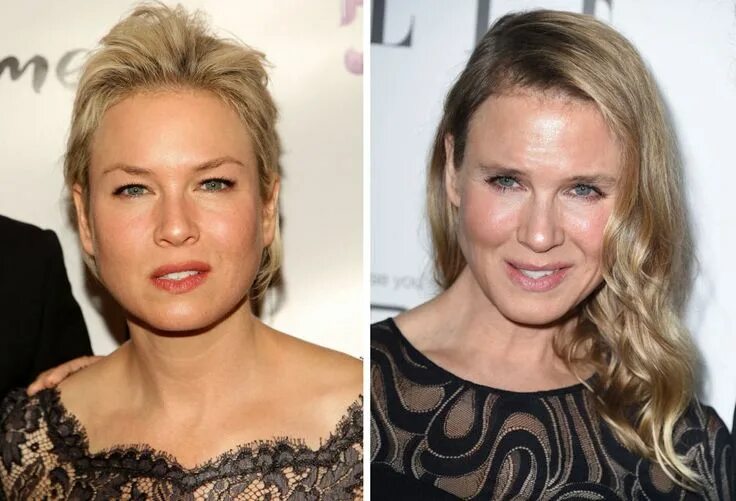 Рене зеллвегер до и после пластики фото Renée Zellweger, Before and After Bad celebrity plastic surgery, Celebrity plast